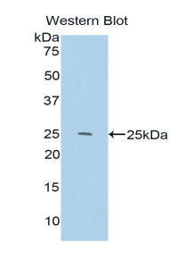 Polyclonal Antibody to Interleukin 33 (IL33)