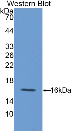 Polyclonal Antibody to Fatty Acid Binding Protein 5 (FABP5)