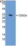 Polyclonal Antibody to Hemopexin (HPX)