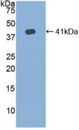 Polyclonal Antibody to Hemojuvelin (HJV)