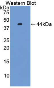 Polyclonal Antibody to Hemojuvelin (HJV)