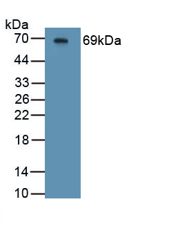 Polyclonal Antibody to Hemojuvelin (HJV)
