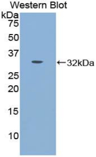 Polyclonal Antibody to Cadherin 16 (CDH16)