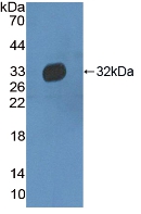 Polyclonal Antibody to Haptoglobin Related Protein (HPR)