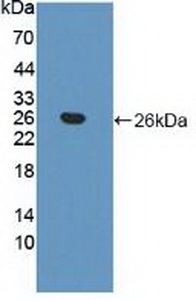 Polyclonal Antibody to Apolipoprotein B (APOB)