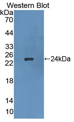 Polyclonal Antibody to Apolipoprotein B (APOB)