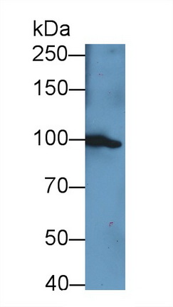 Polyclonal Antibody to Complement Factor B (CFB)