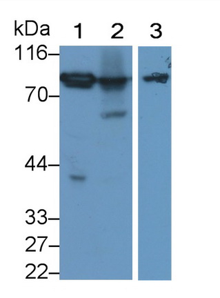 Polyclonal Antibody to Complement Factor B (CFB)