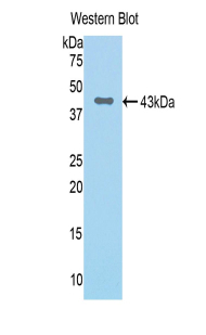 Polyclonal Antibody to Complement Factor B (CFB)