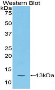 Polyclonal Antibody to S100 Calcium Binding Protein A4 (S100A4)