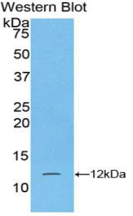 Polyclonal Antibody to S100 Calcium Binding Protein A5 (S100A5)