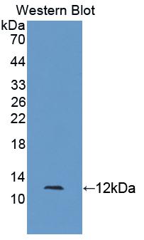 Polyclonal Antibody to S100 Calcium Binding Protein A5 (S100A5)