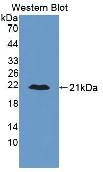 Polyclonal Antibody to Aldehyde Dehydrogenase, Mitochondrial (ALDH2)