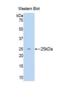 Polyclonal Antibody to Cytokeratin 8 (CK8)