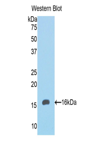 Polyclonal Antibody to Cytokeratin 8 (CK8)