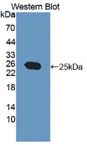 Polyclonal Antibody to O-6-Methylguanine DNA Methyltransferase (MGMT)