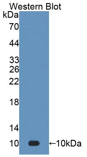 Polyclonal Antibody to S100 Calcium Binding Protein A7 (S100A7)