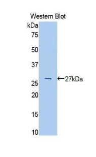 Polyclonal Antibody to Transferrin (TF)