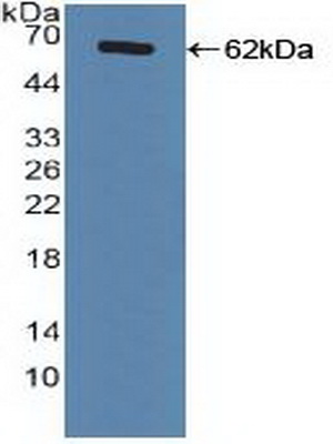 Polyclonal Antibody to Farnesoid X Receptor (FXR)