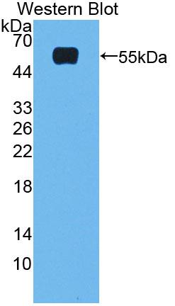 Polyclonal Antibody to Farnesoid X Receptor (FXR)