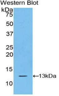 Polyclonal Antibody to S100 Calcium Binding Protein A10 (S100A10)