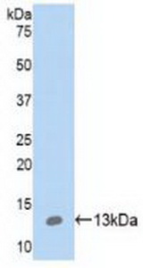 Polyclonal Antibody to S100 Calcium Binding Protein A10 (S100A10)