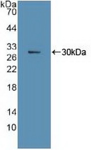 Polyclonal Antibody to Ki-67 Protein (Ki-67)