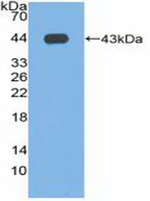 Polyclonal Antibody to Phospholipase D (PLD)