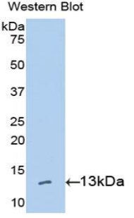 Polyclonal Antibody to High Mobility Group AT Hook Protein 1 (HMGA1)