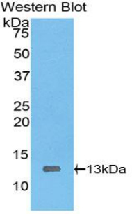 Polyclonal Antibody to High Mobility Group AT Hook Protein 1 (HMGA1)