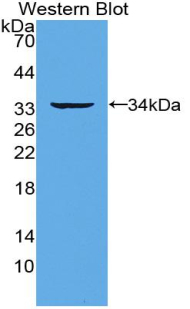 Polyclonal Antibody to Receptor Activator Of Nuclear Factor Kappa B (RANk)
