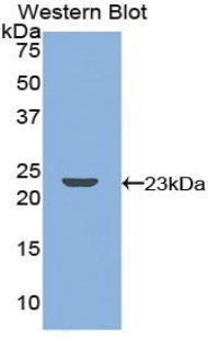 Polyclonal Antibody to Receptor Activator Of Nuclear Factor Kappa B (RANk)