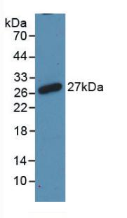 Polyclonal Antibody to Receptor Activator Of Nuclear Factor Kappa B (RANk)