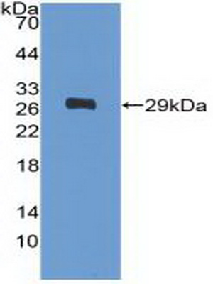 Polyclonal Antibody to Platelet Derived Growth Factor Receptor Alpha (PDGFRa)