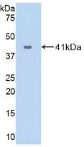 Polyclonal Antibody to VEGF Co Regulated Chemokine 1 (VCC1)