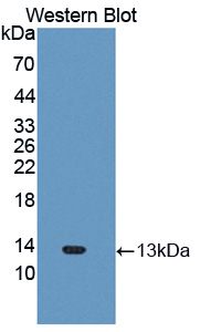 Polyclonal Antibody to Interferon Inducible T-Cell Alpha Chemoattractant (ITaC)