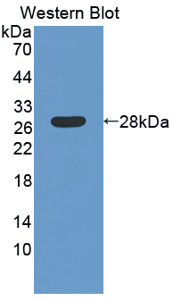 Polyclonal Antibody to Laminin Beta 4 (LAMb4)
