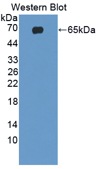 Polyclonal Antibody to Laminin Beta 2 (LAMb2)