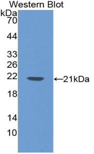 Polyclonal Antibody to Laminin Beta 2 (LAMb2)