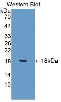 Polyclonal Antibody to Laminin Beta 2 (LAMb2)