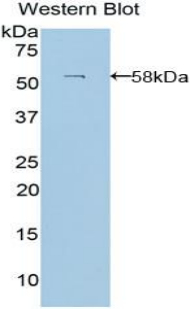 Polyclonal Antibody to Laminin Beta 3 (LAMb3)