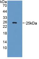 Polyclonal Antibody to Laminin Beta 3 (LAMb3)