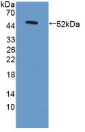 Polyclonal Antibody to Laminin Gamma 3 (LAMC3)