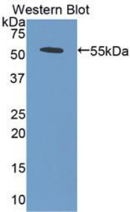 Polyclonal Antibody to Bone Morphogenetic Protein 5 (BMP5)