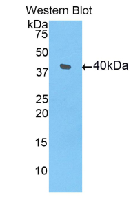 Polyclonal Antibody to Bone Morphogenetic Protein 10 (BMP10)