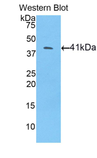 Polyclonal Antibody to Bone Morphogenetic Protein 10 (BMP10)