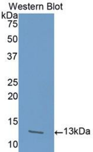 Polyclonal Antibody to Activin A Receptor Type I B (ACVR1B)