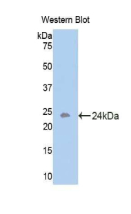 Polyclonal Antibody to Activin A Receptor Type I B (ACVR1B)