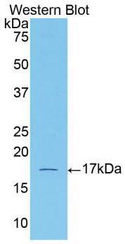 Polyclonal Antibody to Activin A Receptor Type II A (ACVR2A)