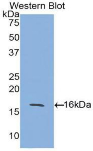 Polyclonal Antibody to Activin A Receptor Type II A (ACVR2A)